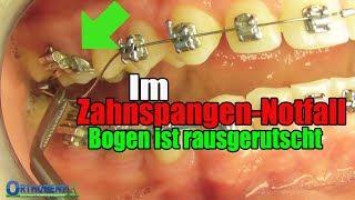 Im Zahnspangen-Notfall, Bogen ist RAUS, feste Zahnspange, Kieferorthopäde | Orthodentix