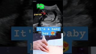 Ultrasound showing boy baby !!! | 25 weeks