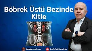 Böbrek Üstü Bezi Tümörüne Dikkat! Böbrek üstü bezi hastalığı nasıl anlaşılır?