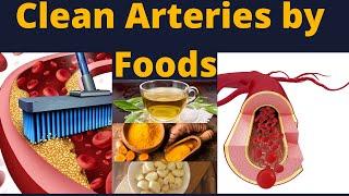 Foods that clean your arteries naturally | super foods to clean your arteries | unclog arteries |