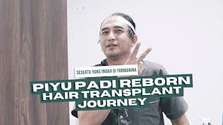 Piyu Padi Reborn Hair Transplant Journey