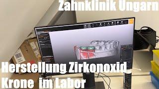 Herstellung Zirkonoxid Krone (Zirkon-Vollkeramikkrone) im Labor (Design, CNC, Brennen, & Kosten)