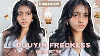 FRECKLES DOUYIN MAKEUP ON BROWN ACNE SKIN 🫧