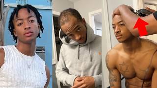 Balding At 21 - Shaving My Balding hair & Gaining Confidence