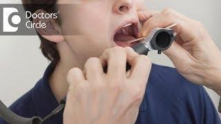 Common causes of Throat Pain and Irritation - Dr. Sriram Nathan