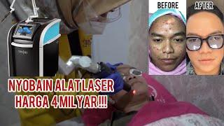 laser wajah paling ampuh , harga alatnya 4 milyar !!! picosure JERAWAT HILANG , NYATA!