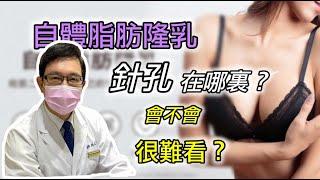 自體脂肪隆乳的針孔在哪裡？會不會很難看？