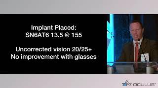 Brandon Ayers, MD – Improving Quality of Vision with the OCULUS Pentacam®