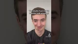 How Plastic Surgery Changed My Life!