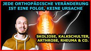 Jede ORTHOPÄDISCHE VERÄNDERUNG (Skoliose, Arthrose, Kalkschulter, Rheuma) ist FOLGE, nicht URSACHE