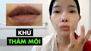 24 ngày khử thâm môi đơn giản dễ làm tại nhà