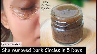 i Removed DARK CIRCLES in 5 Days | Under Eye WRINKLES, Eye Bags -  Coffee Eye Mask & Coffee Eye Gel