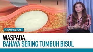 Tumbuh Bisul, Pertanda Daya Tahan Tubuh yang Lemah | Hidup Sehat tvOne