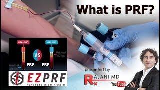 What is PRF-Dr Rajani