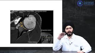 Premium Video Unlocked: MRI Shoulder by Exemplary Surgeon Dr.Harpreet @ConceptualOrthopedics