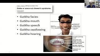 Management of neck node metastasis in Oral Cancer - Prof  Pankaj Chaturvedi