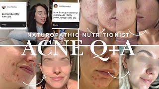 ACNE Q+A  Naturopathic Nutritionist + Acne Specialist