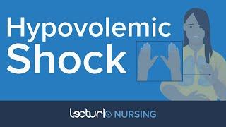 Hypovolemic Shock | Medical Surgical Nursing