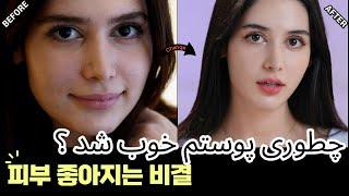 나의 피부관리 | Tips for healthy skin | چطوری  تونستم  پوستمو خوب کنم