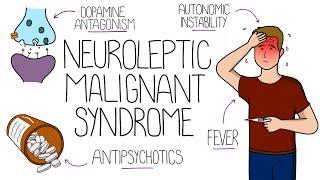 Neuroleptic Malignant Syndrome (NMS) Explained