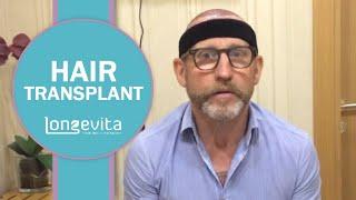 Is Hair Transplantation Painful? I Longevita