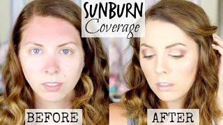 How to Cover Sunburn / Rosacea with Makeup!  Tutorial by ColorMeCassie