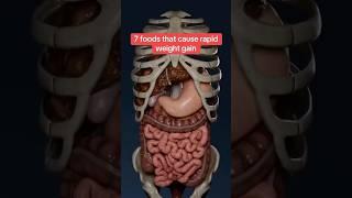 7 Foods That Cause Rapid Weight Gain  Doctor Reacts