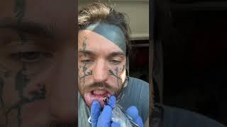 Tattooing my LIPS