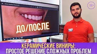 Простое решение сложных проблем! [Dental Guru]