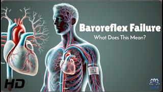 Baroreflex Failure: The Hidden Danger Affecting Your Heart!