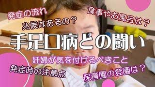 【手足口病との闘い】年子兄弟と妊婦ママの闘病の１日｜発症の予兆が？｜手足口病の注意点とは？｜妊婦さんは大丈夫？！｜さつきの機嫌が悪すぎて、自分が何を言っているのか分からなくなった日