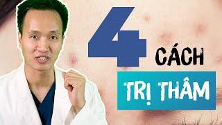 4 cách TRỊ THÂM MỤN đơn giản trong Skincare tại nhà và Clinic| Dr Hiếu