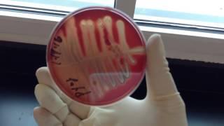 TSA Sheep's Blood Medium - Hemolysis