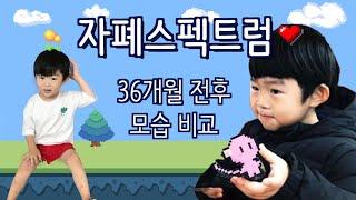 [eng] 자폐스펙트럼 36개월 전후 달라진 모습 비교/ 자폐증 증상