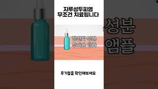 지루성두피 꼭 이렇게 하셔야 합니다