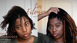 DIY Microlocs Journey- 10th Month Update! | Loc Extensions Installation!! | Naetorious Locs