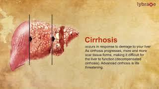 Liver Cirrhosis - How Can Ayurveda Help?
