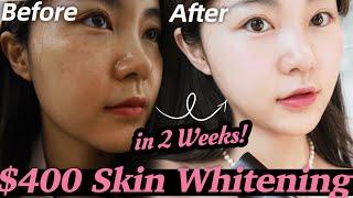 REAL EXPERIENCE: k-pop idols whitening treatment! Unexpected results!  | Lyn Beauty