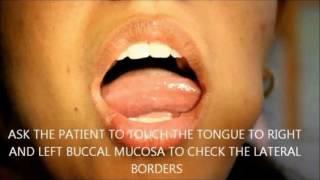 Clinical Examination of the Tongue