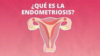 ¿Qué es la endometriosis?