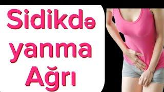 SİDİKDƏ YANMA və Ağrı