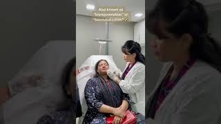 Meso-Botox by Dr. Sharmin at Laser Treat 