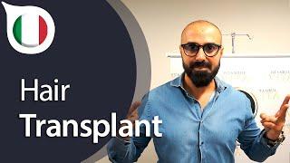 My Experience with Istanbul Vita from İtaly | Hair Transplant in Istanbul / Turkey