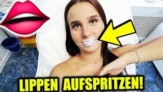 MEINE NEUEN LIPPEN !  (geschwollen) | Celina