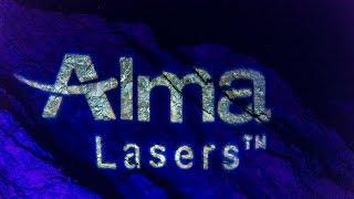 Introducing Alma Lasers 2017 Overview