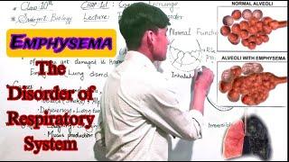 Emphysema _ The disorder of Respiratory System Class 10th Biology