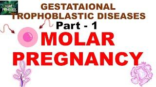 Gestational trophoblastic diseases: Part 1: Complete and Partial Hydatidiform Moles