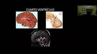 Clase 5: Anatomía del SNC