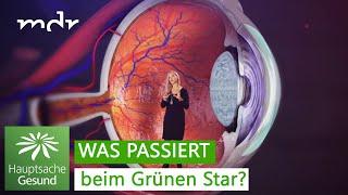 Grüner Star - schmerzlos und heimtückisch | Hauptsache gesund | MDR