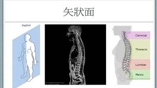 阎晓华说侧弯第十一章：关注脊柱的侧面曲线